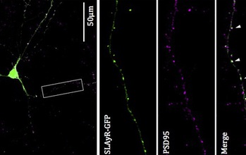 Brain nerve cells